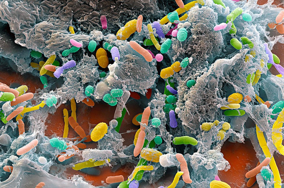 Microbiome-Based Cancer Dx Emerges From Cancer Genome Atlas Reanalysis